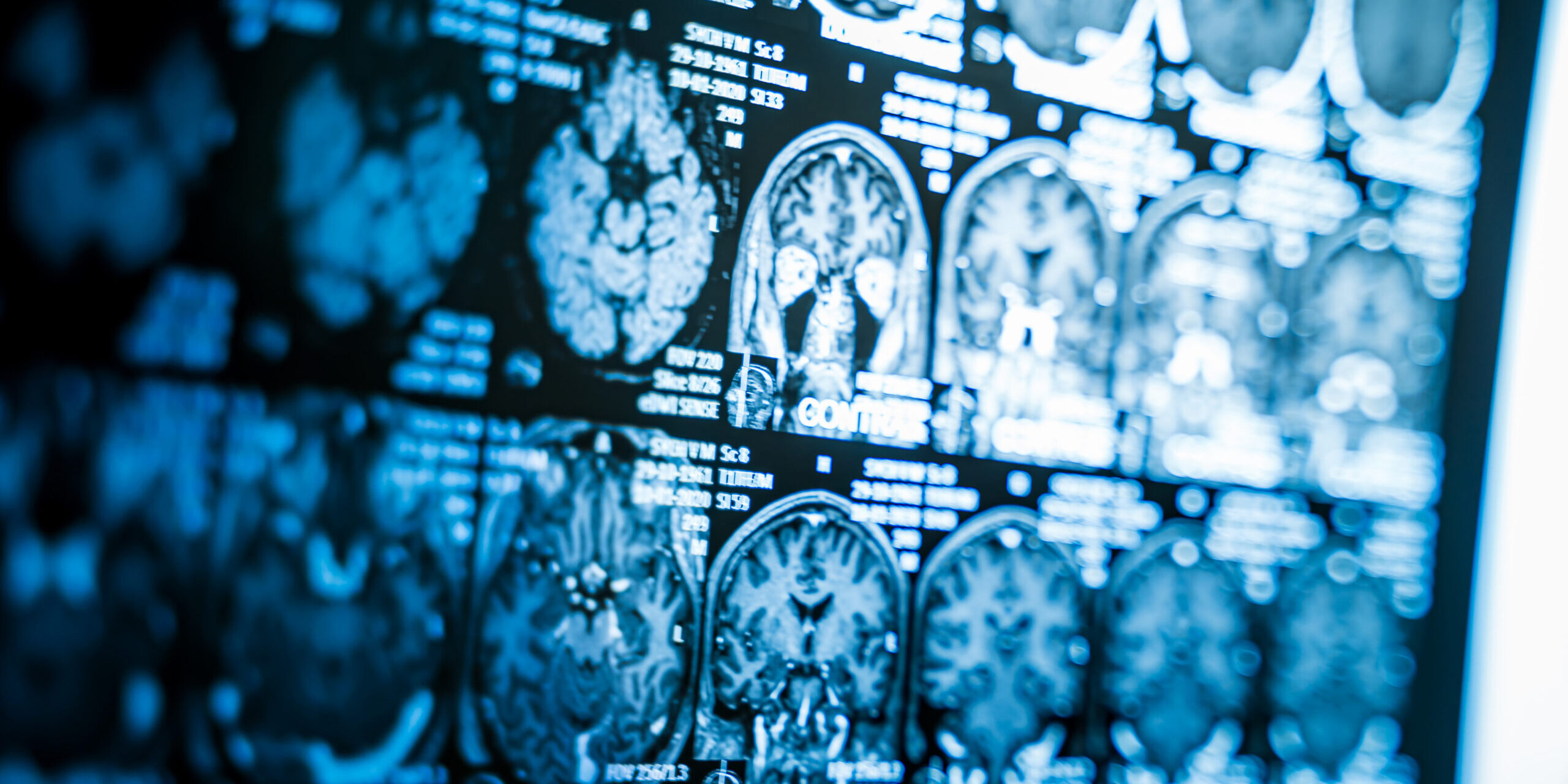 Scottish Labour Will Deliver AI Hospital Scanners