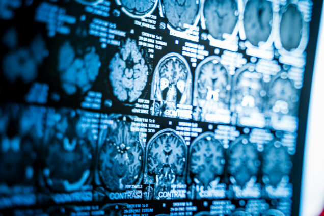 Scottish Labour Will Deliver AI Hospital Scanners